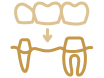 Bridges and Denturess